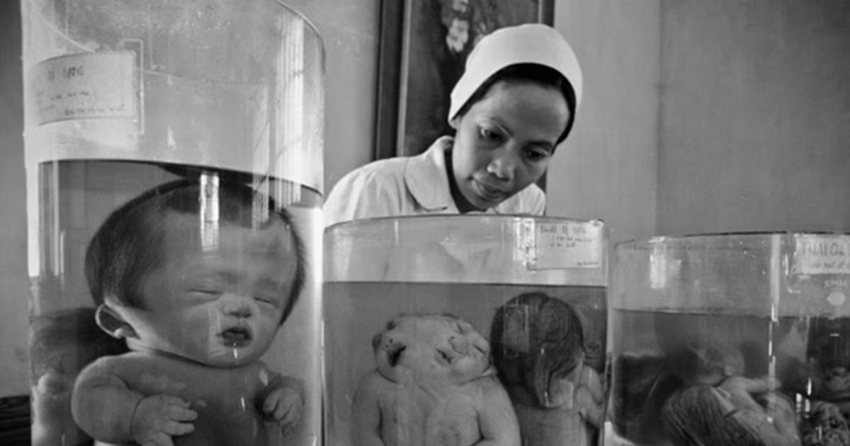 क्या था ‘एजेंट आरेंज’, जिसे अमेरिका ने वियतनाम युद्ध में इस्तेमाल किया, अपंग हो रहीं पीढ़ियां, खेत हो गए बंजर